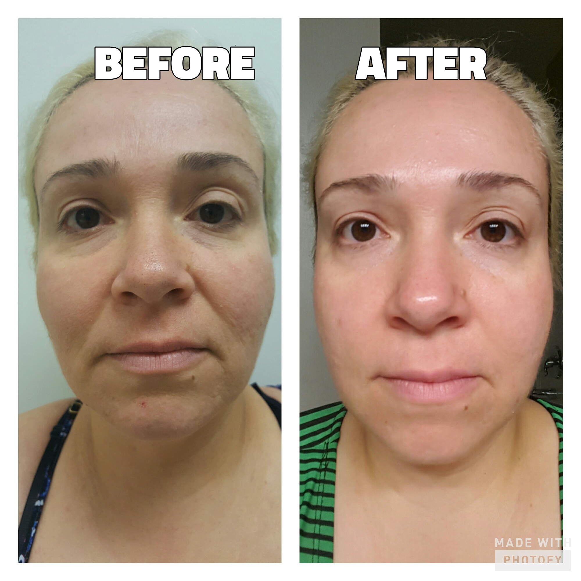 pumpkin-enzyme-mask-before-and-after