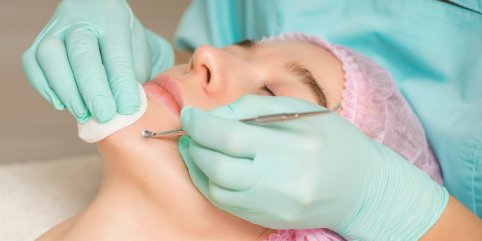 extractions for microdermabrasion