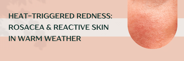 Heat-Triggered Redness: Rosacea & Reactive Skin in Warm Weather