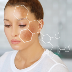hyperpigmentation